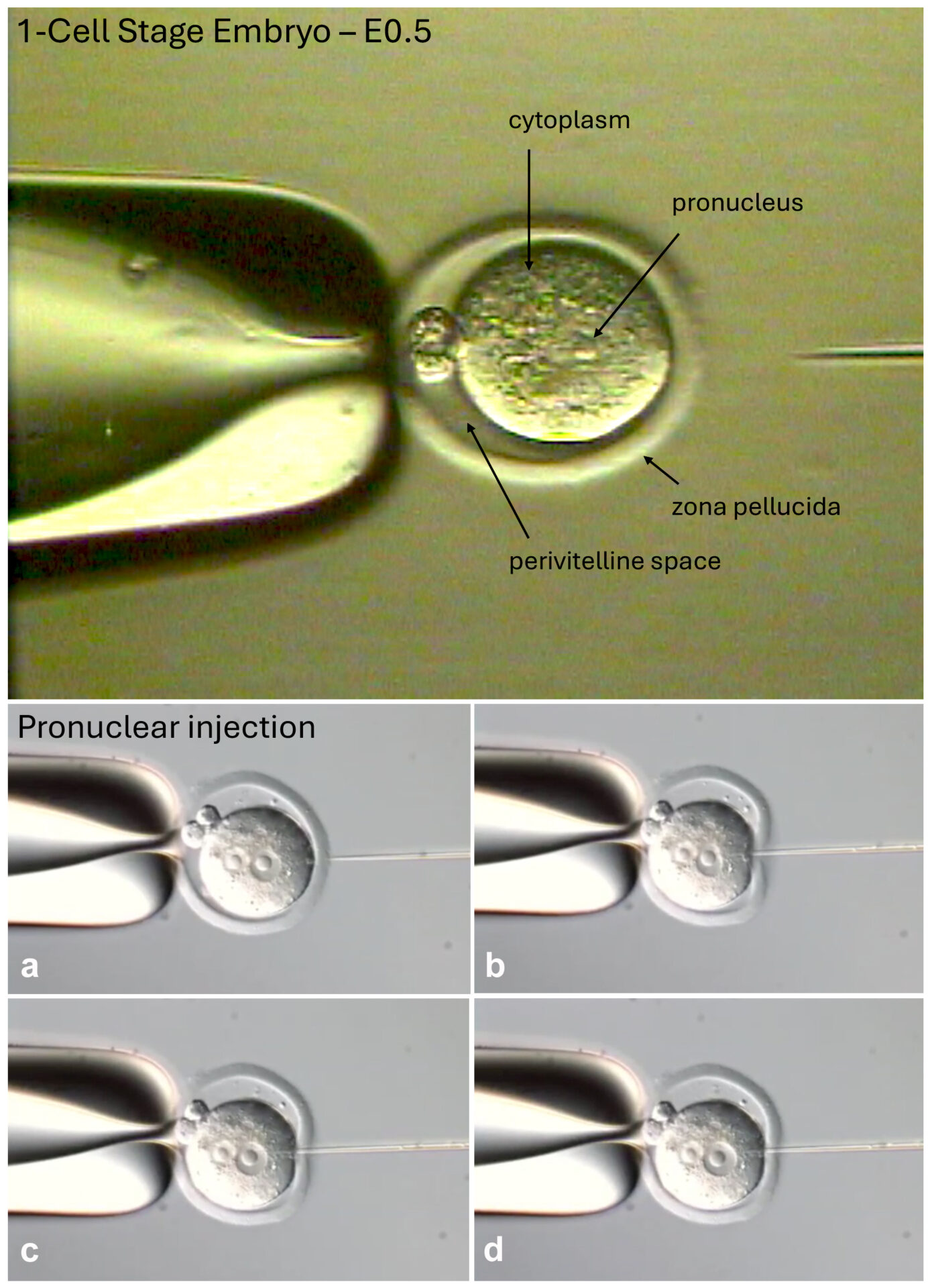 dnainjectionrev