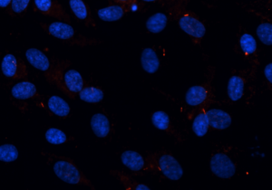 human-retina-pigmented-epithelium-rpe1-cells-labeled-with-arl13b-hire-rabbit-antibody-5120x2880