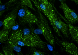 human-rpe1-cells-labeled-with-abcd1-human-antibody-4096x2304