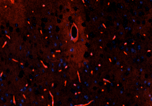 mouse-brain-section-labeled-with-aqp4-antibody-shank1-aqp4-dataset-2048x1152