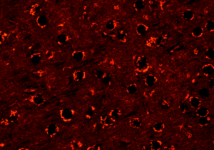 mouse-brain-section-labeled-with-chrna1-antibody-5120x2880
