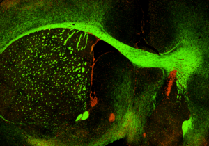 mouse-brain-section-labeled-with-chrna2-and-mag-antibody-4096x2304-2