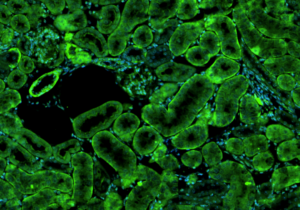 mouse-kidney-ffpe-section-labeled-with-pth1r-antibody-2048x1152