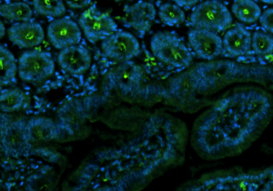 mouse-small-intestine-section-labeled-with-claudin-2-antibody-5120x2880