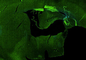 psen2