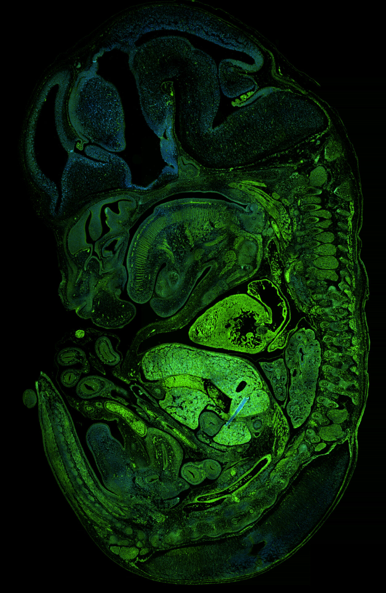 mouse-embryo-ffpe-section-e14-5-labeled-with-fbxw11-antibody-bicell