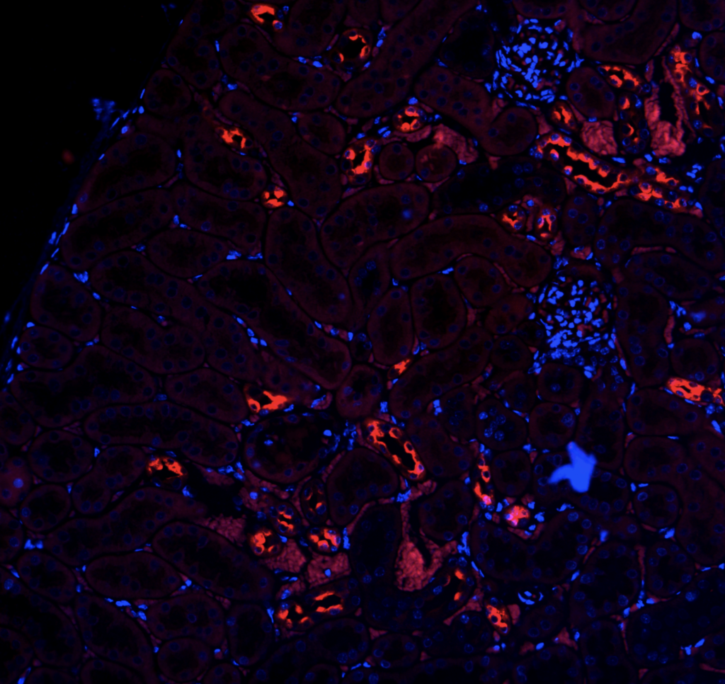 Mouse kidney section labeled with Aquaporin-2 antibody (from Pendrin ...